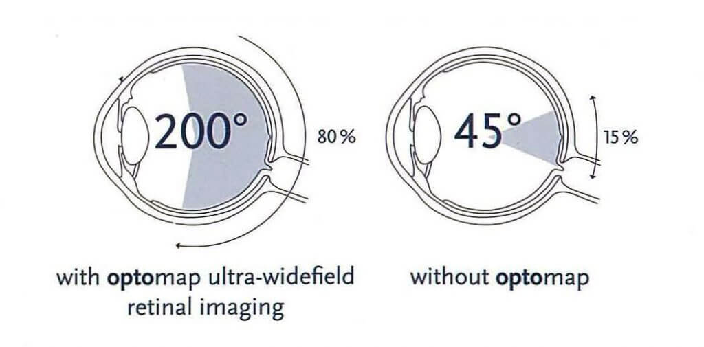 optos 3